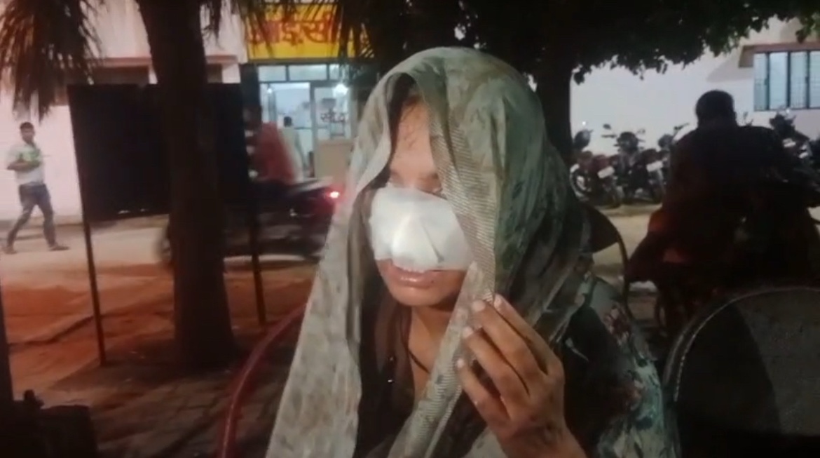 पति ने पत्नी की अपने दाँतो से काटी नाक, पत्नी के अवैध संबंधों से था परेशान, पुलिस ने किया गिरफ्तार